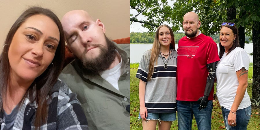 Diptych photos. Left photo, selfie taken by Meagan James , on the left, with husband Aaron James, right, who is a whole-eye and partial face transplant recipient. Right photo, portrait of Aaron James, center, who is a whole-eye and partial face transplant recipient, with his family. His daughter stands to the left of Aaron, and his wife, Meagan, stands to the right.